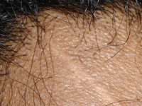474299142?file=thumbnail