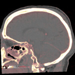 5999n393v?file=thumbnail