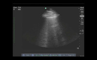 Kh04dp788?file=thumbnail