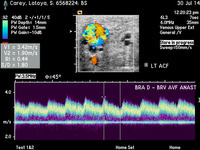 Z890rv02z?file=thumbnail